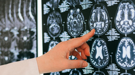 Il significato neurologico del sonno e dei sogni