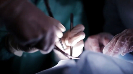 A Frosinone asportato tumore di 228 cm³ dal basicranio di una 54enne