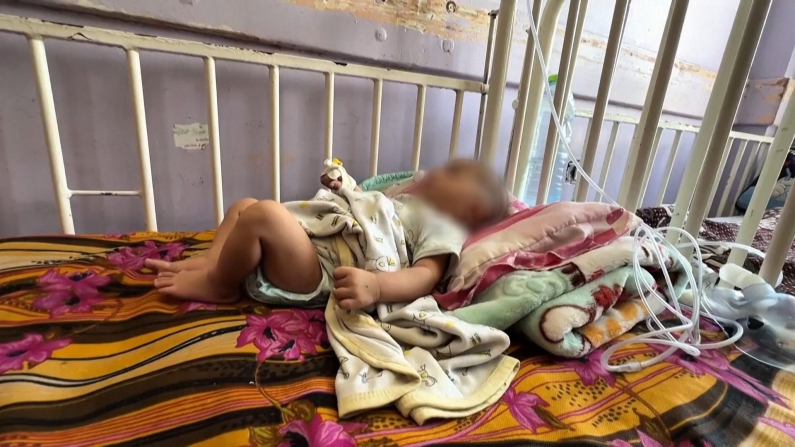 Bambini di Gaza malnutriti (Immagine: Reuters)